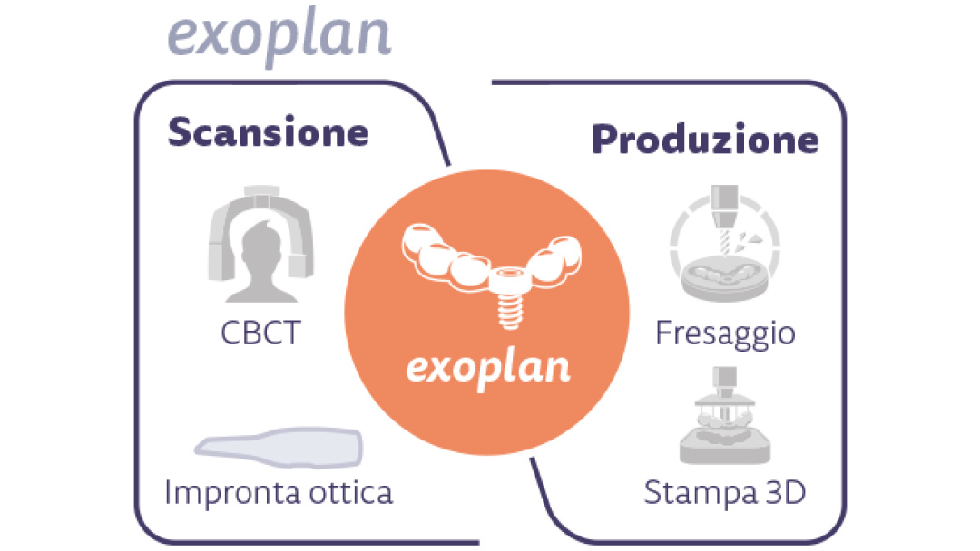 myray-exocad-exoplan