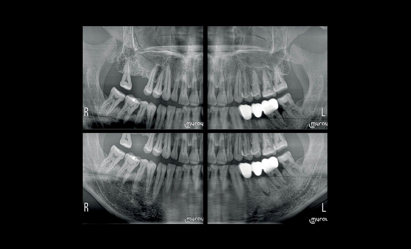 Ortopanoramiche_4
