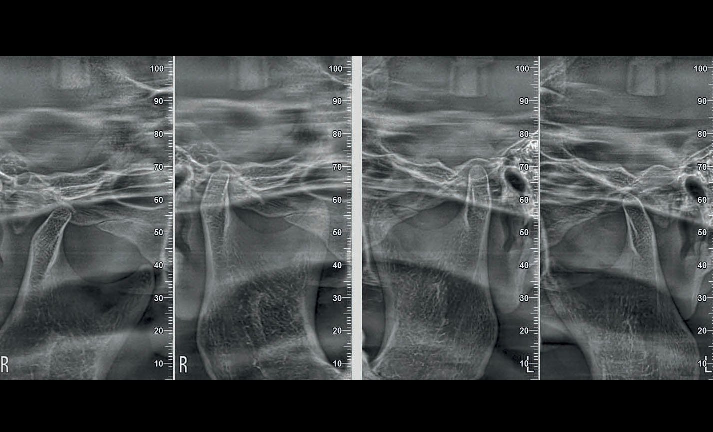 Stratigrafie extraorali