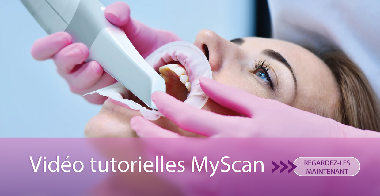 tutorial_myscan_fra