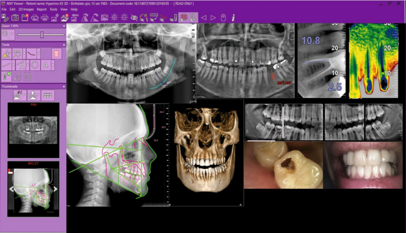 multidextop_2_2