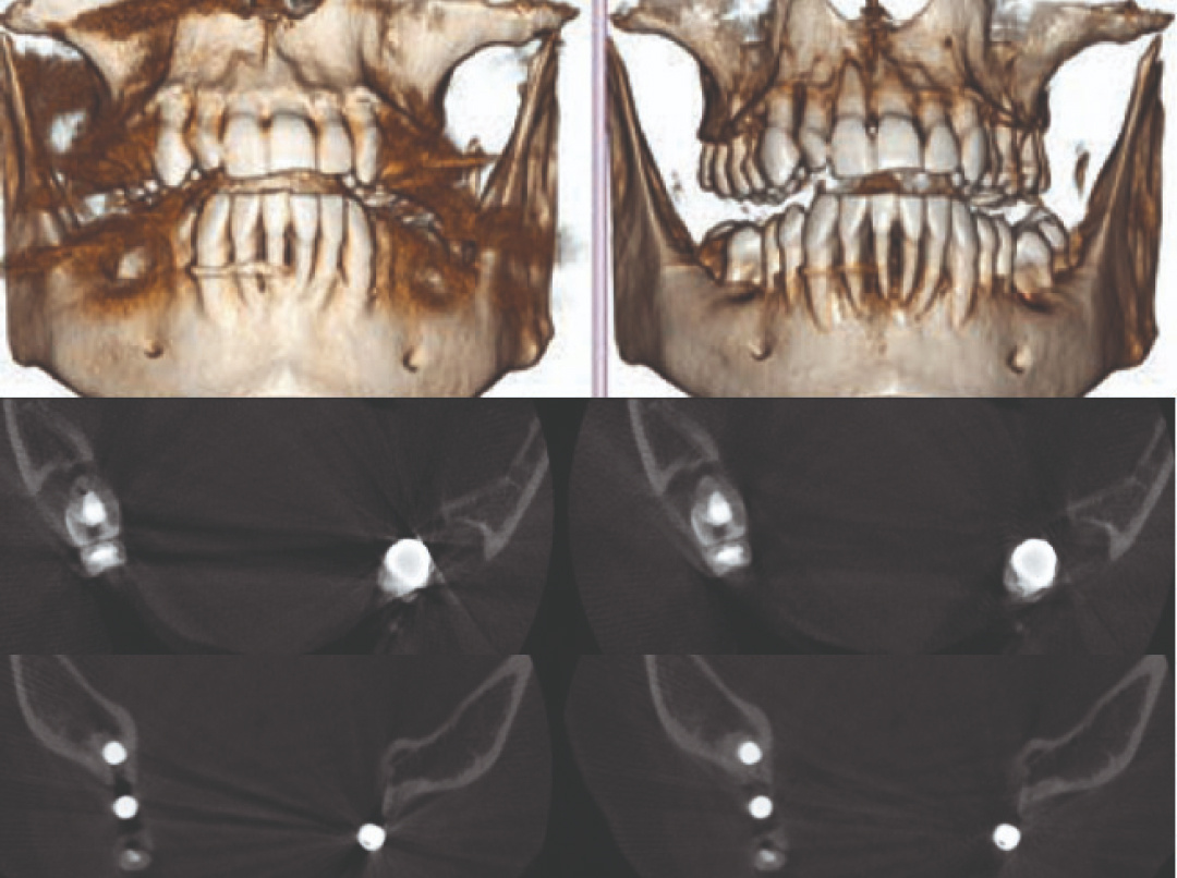 irys-3dsmart