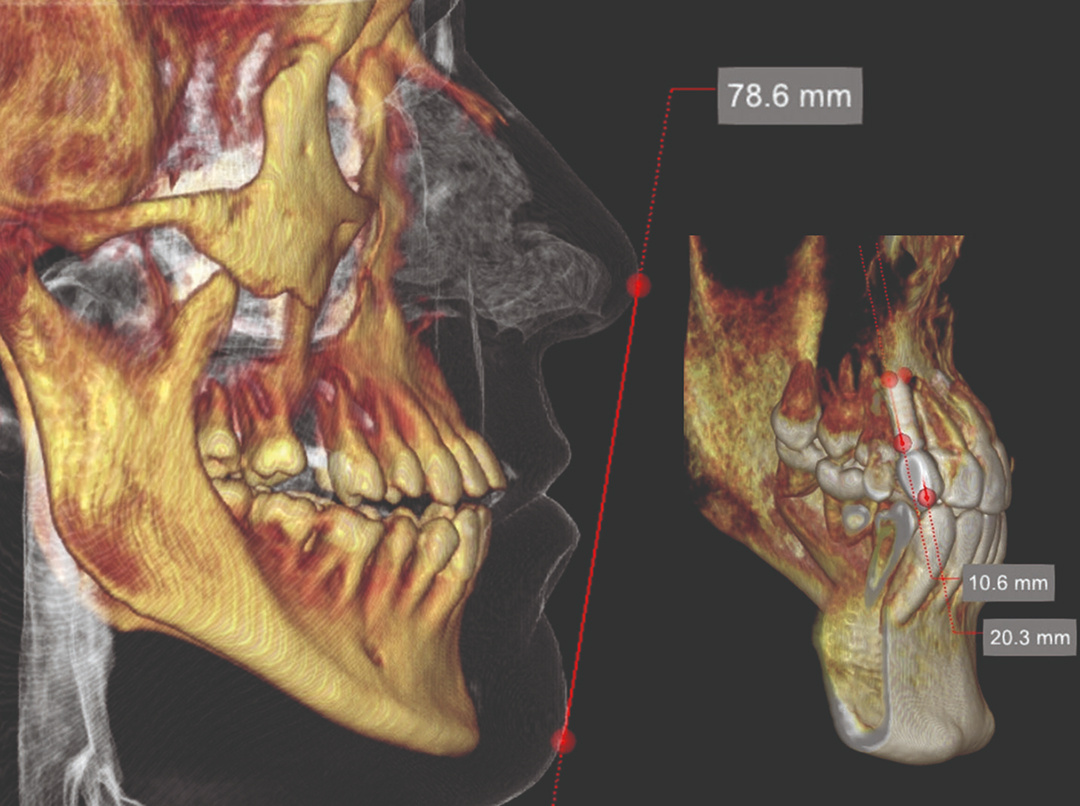 irys-casi3d-analisi