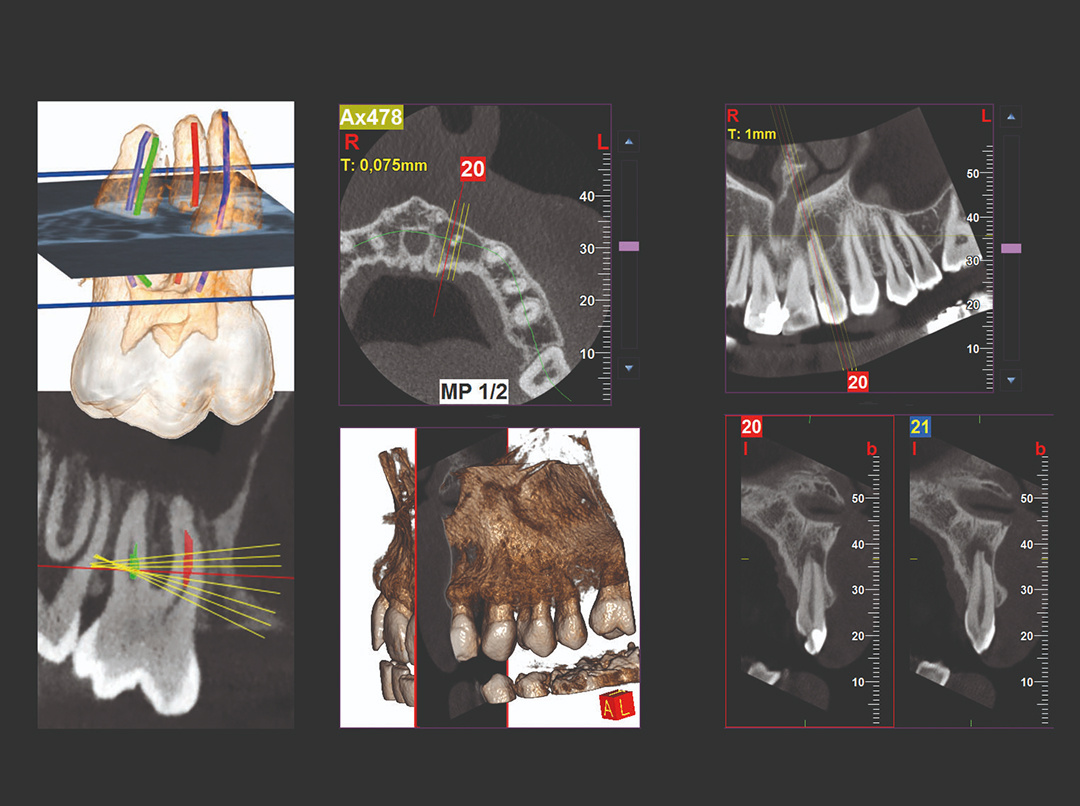 irys-casi3d-indagine